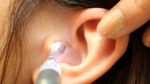 Relacionada oirnatur-revision-auditiva-cerumen-768x445.jpg
