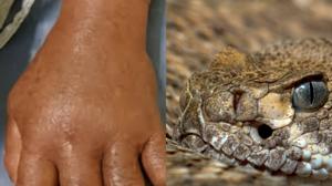 Relacionada serpiente.jpg