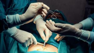 Relacionada cnne-1328142-cuales-son-las-cirugias-esteticas-mas-populares-en-el-mundo.jpg