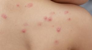 Relacionada download-70.jpg