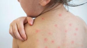 Relacionada 33d4f94d-4177-4094-89c1-a1315dd34a42.jpg