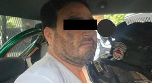 Relacionada botox.jpg