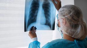 Relacionada neumonia.jpg