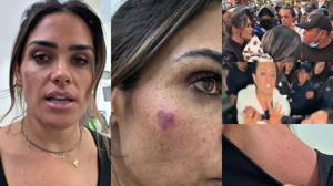 Relacionada alessandra-rojo-golpeada.jpg