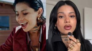 Relacionada nodal.jpg